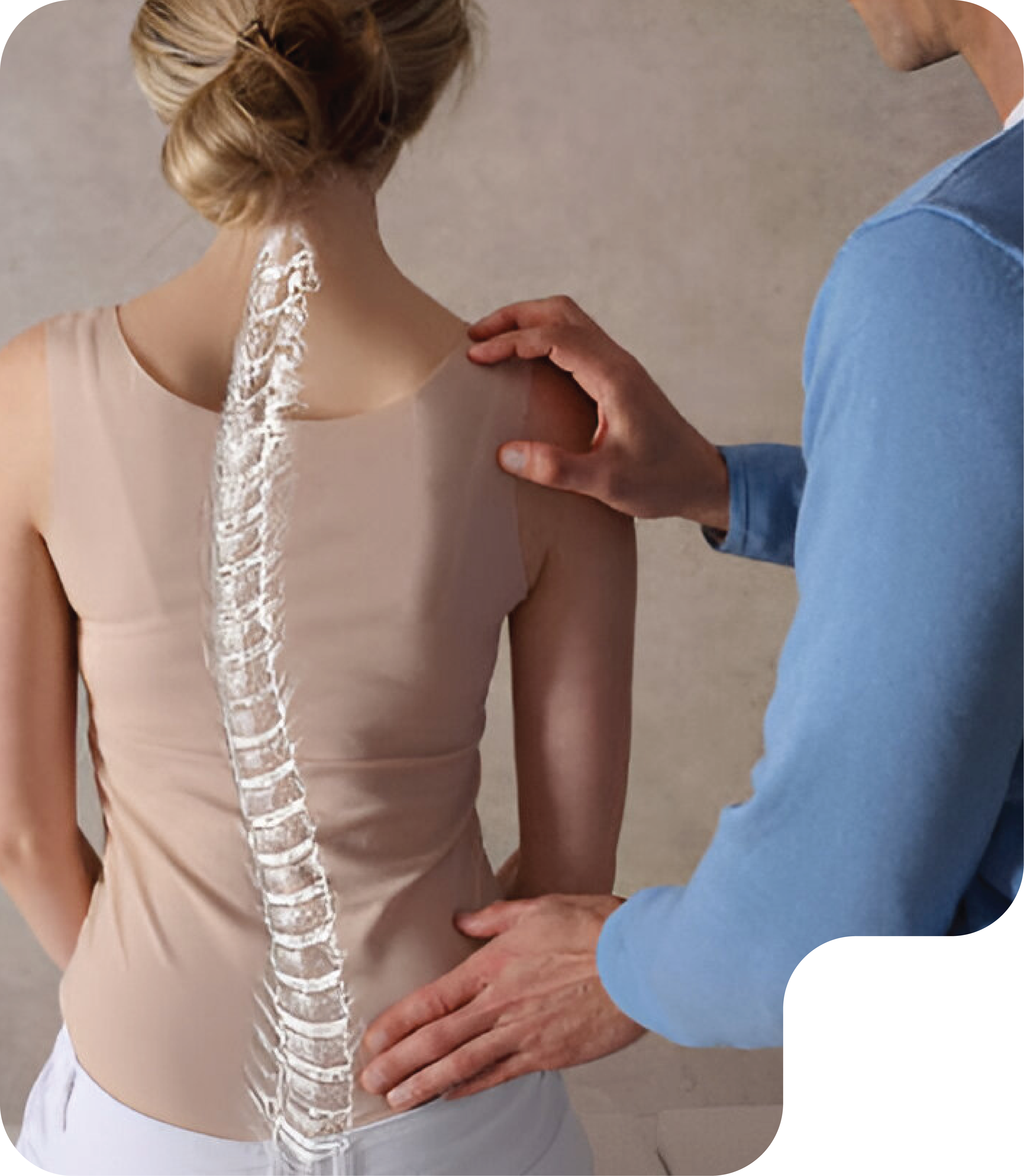 Scoliosis and Postural Issues